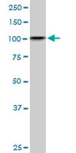 DDX11 Antibody in Western Blot (WB)