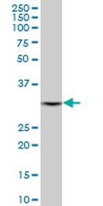 DECR1 Antibody in Western Blot (WB)