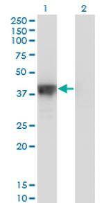 DFFA Monoclonal Antibody (3A11)