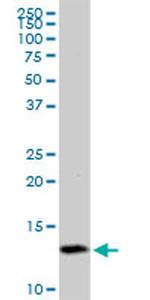 TIMM8A Antibody in Western Blot (WB)
