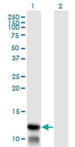 TIMM8A Antibody in Western Blot (WB)