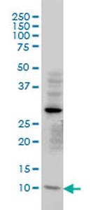 TIMM8A Antibody in Western Blot (WB)