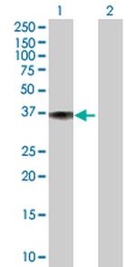 DFNA5 Polyclonal Antibody, MaxPab™