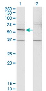 DFNA5 Monoclonal Antibody (1E10)