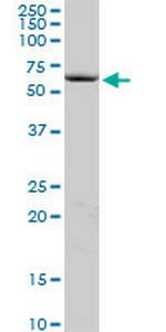 COCH Antibody in Western Blot (WB)