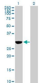 NQO1 Antibody in Western Blot (WB)
