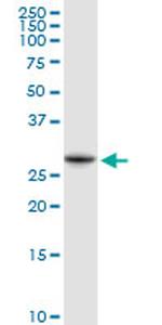 NQO1 Antibody in Western Blot (WB)