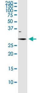 NQO1 Antibody in Western Blot (WB)