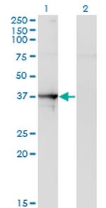 SEPT1 Antibody in Western Blot (WB)