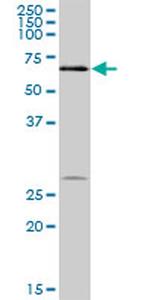 DKC1 Antibody in Western Blot (WB)