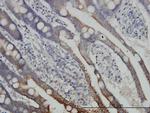 DLD Monoclonal Antibody (1G11)