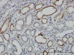 DLD Monoclonal Antibody (2D4)