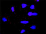 DLG1 Monoclonal Antibody (1D8)
