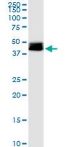 DLST Polyclonal Antibody, MaxPab™