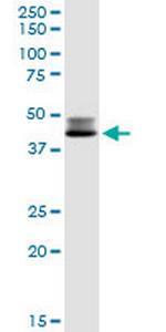 DLST Polyclonal Antibody, MaxPab™