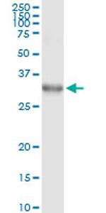 DLX1 Antibody in Immunoprecipitation (IP)