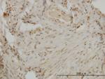 DLX2 Monoclonal Antibody (2B12)