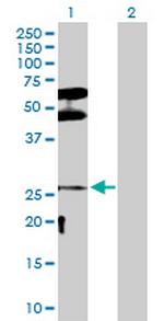 DLX3 Polyclonal Antibody, MaxPab™