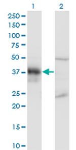 DLX3 Monoclonal Antibody (3B8)