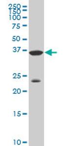 DLX3 Antibody in Western Blot (WB)