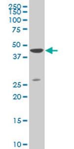 DLX3 Antibody in Western Blot (WB)