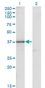 DLX3 Antibody in Western Blot (WB)