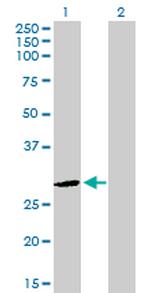 DLX4 Polyclonal Antibody, MaxPab™