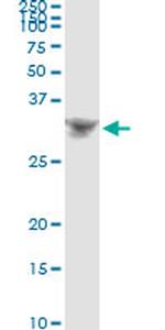 DLX4 Antibody in Immunoprecipitation (IP)