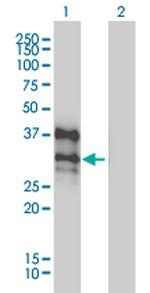 DLX4 Antibody in Western Blot (WB)