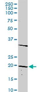 DLX6 Antibody in Western Blot (WB)