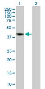 DMRT1 Polyclonal Antibody, MaxPab™