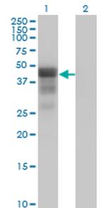DMRT1 Monoclonal Antibody (1G11)
