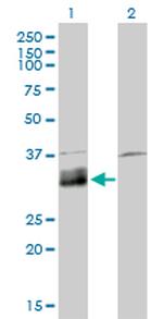 DNASE1L1 Antibody in Western Blot (WB)