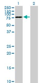 DYNC1I2 Antibody in Western Blot (WB)