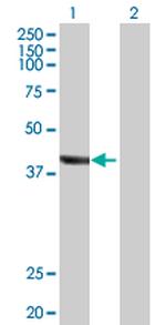 TRDMT1 Polyclonal Antibody, MaxPab™