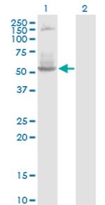 DNTT Monoclonal Antibody (4H5)