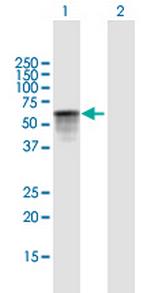DOK1 Antibody in Western Blot (WB)