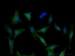 DPYD Monoclonal Antibody (7D4)