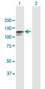 DSC2 Polyclonal Antibody, MaxPab™