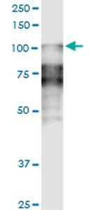 DSC2 Monoclonal Antibody (1F2)