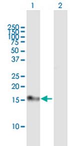 DSCR1 Polyclonal Antibody, MaxPab™
