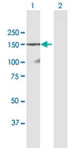 DSG1 Polyclonal Antibody, MaxPab™