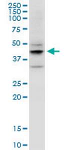 EPYC Monoclonal Antibody (2G6)