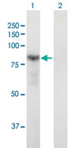 DTNA Antibody in Western Blot (WB)