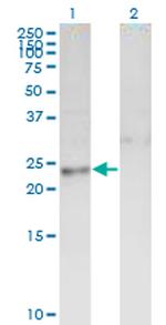 DTYMK Antibody in Western Blot (WB)