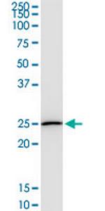 DTYMK Monoclonal Antibody (2G11)