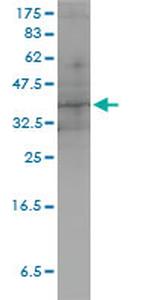 DUSP4 Monoclonal Antibody (3D6-G6)
