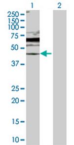 DUSP6 Polyclonal Antibody, MaxPab™
