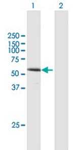 DVL1 Polyclonal Antibody, MaxPab™