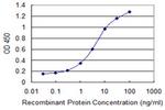 E4F1 Antibody in ELISA (ELISA)